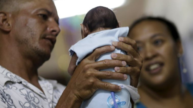 תינוקת הסובלת ממיקרוצפליה, כתוצאה מנגיף הזיקה בברזיל (צילום: רויטרס)