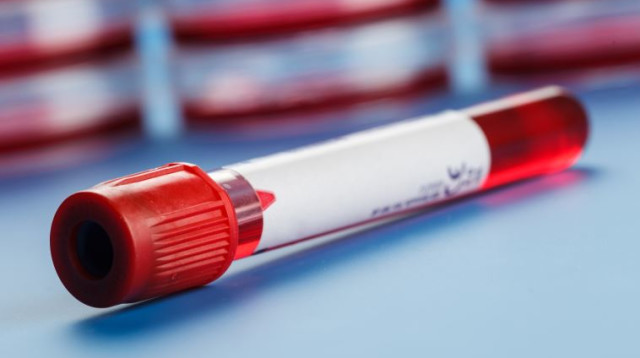 מבחנה עם דם (צילום: אינגאימג)