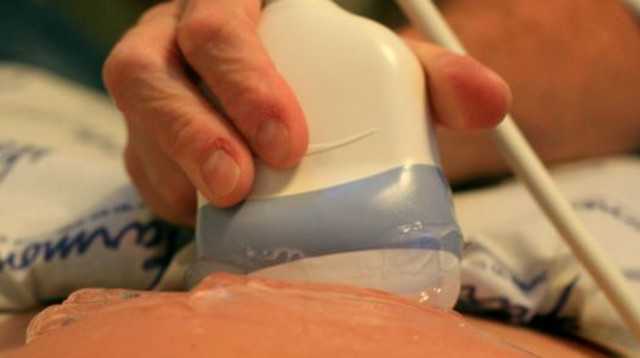 אישה בהריון בבדיקה אצל גניקולוג, ארכיון (צילום: חן לאופולד, פלאש 90)