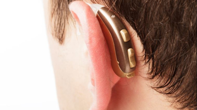 מכשיר שמיעה (צילום: אינגאימג)