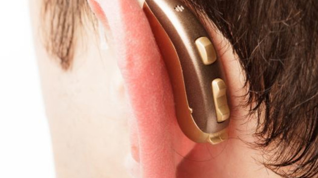 מכשיר שמיעה (צילום: אינגאימג)