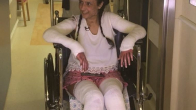 עדן דדון, הפצועה מקו 12 בירושלים (צילום: דוברות הדסה)