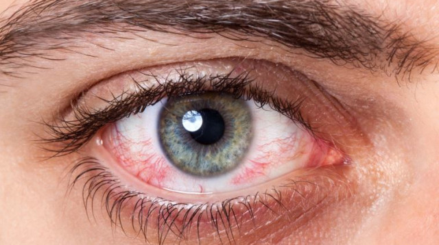 עין (צילום: אינגאימג)