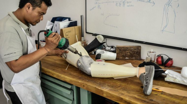 פרוטזה (צילום: Getty images)