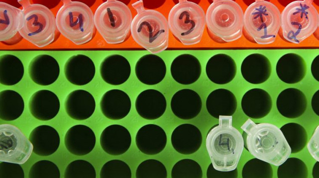 מעבדה, ארכיון (צילום: פלאש 90)