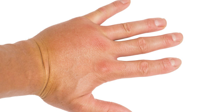 כף היד (צילום: אינגאימג')