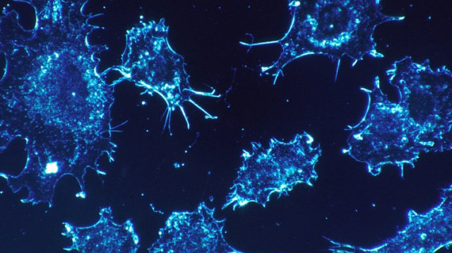 תאי סרטן. טיפול בהתאם למפה הגנומית של כל מטופל  (צילום: Pixabay)