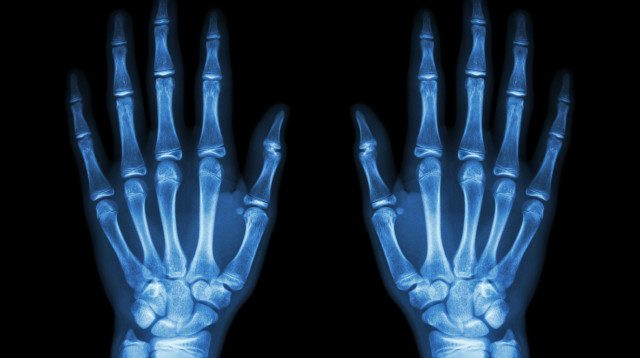 צילום רנטגן (צילום: istockphoto)