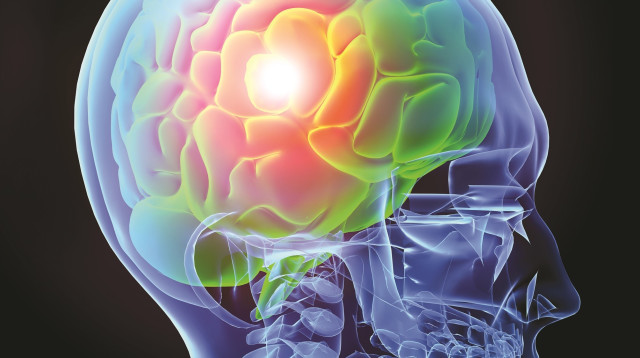 אפילפסיה, אילוסטרציה (צילום: אינג אימג')