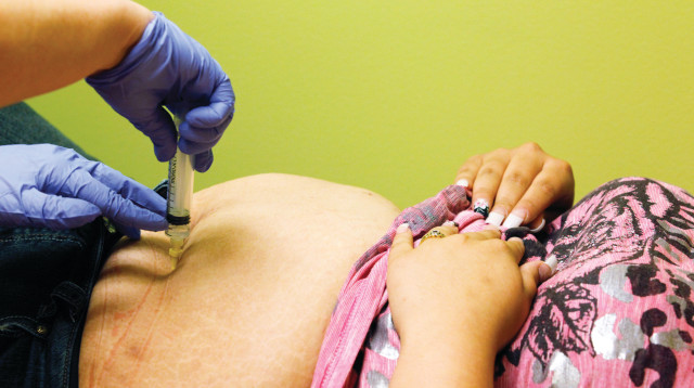 ניתוח קיצור קיבה, אילוסטרציה (צילום: רויטרס)