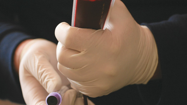 מנות דם (צילום: רבקה זפרט, פלאש 90)