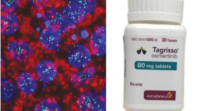 התרופה וגרורות סרטניות (צילום: יח"צ, באדיבות האוניברסיטה העברית)