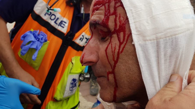 שוטר שנפצע במהלך הפגנה נגד פינוי נתיב האבות  (צילום: דוברות המשטרה)