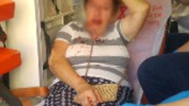 הקשישה שהותקפה בקריית גת (צילום: דוברות המשטרה)
