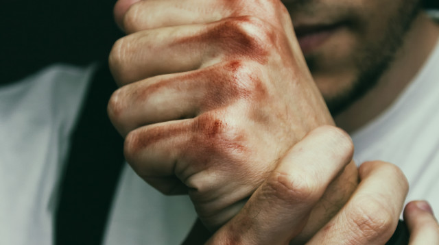 אלימות (צילום: ingimage ASAP)