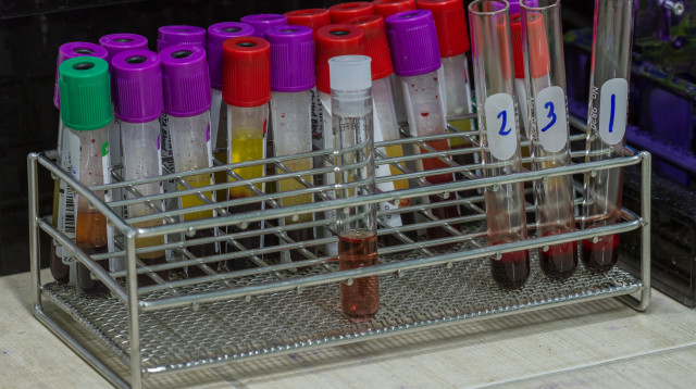 בדיקת דם (אילוסטרציה) (צילום: אינג אימג')