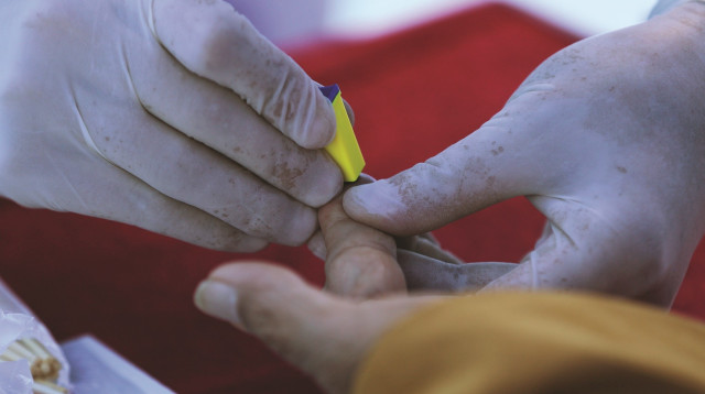 בדיקת איידס (צילום: רויטרס)