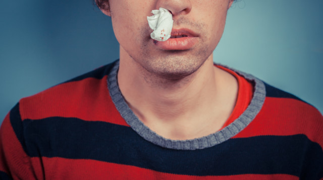 דימום מהאף (צילום: ingimage ASAP)