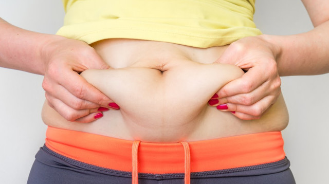 מתיחת בטן (צילום: חברת אסטרטג)