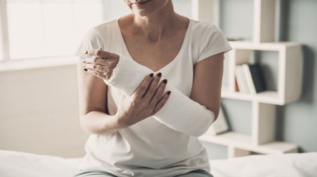 יד חבושה בגבס (צילום: שאטרסטוק)