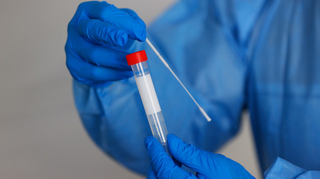 בדיקת קורונה (צילום: Tom Pennington/Getty Images)