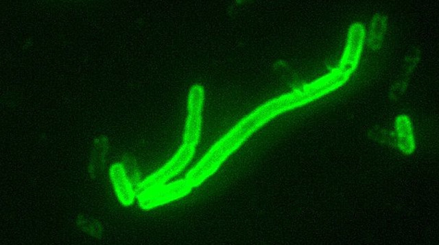 חיידק Yersinia pestis, הגורם למחלת הדבר (צילום: CDC/ Courtesy of Larry Stauffer, Oregon State Public Health Laboratory)