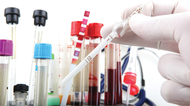 בדיקת דם (צילום: אינג אימג')