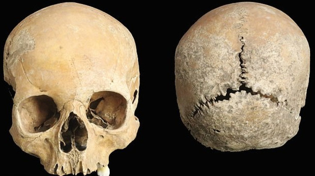 הגולגולת החבולה (צילום: רשתות חברתיות)