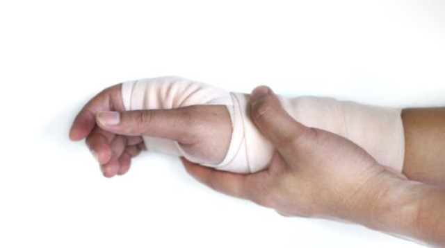 שבר מאמץ (צילום: Shutterstock)