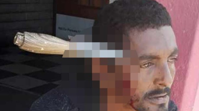 כריסטופר האקר, האזרח שהותקף בראשו (צילום: רשתות חברתיות)