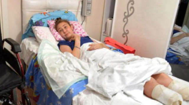 עברה ניתוח אף ורגליה נכרתו (צילום: רשתות חברתיות)