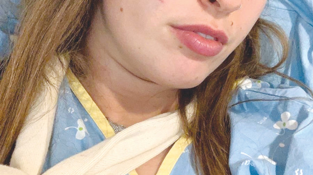 הצעירה שהותקפה על ידי פיטבול (צילום: באדיבות המצולמת)