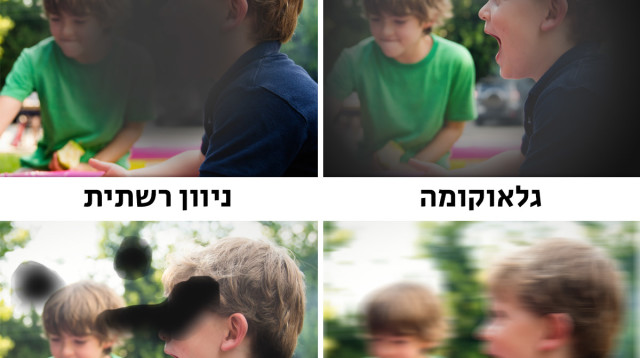 בדיקת ראיה: הדמיית לקויות הראיה במחלות העיניים השונות (צילום: איתי שרף- טיפול במחלות עיניים ברפואה סינית )