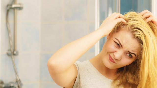 כינים: אילוסטרציה (צילום: gettyimages)