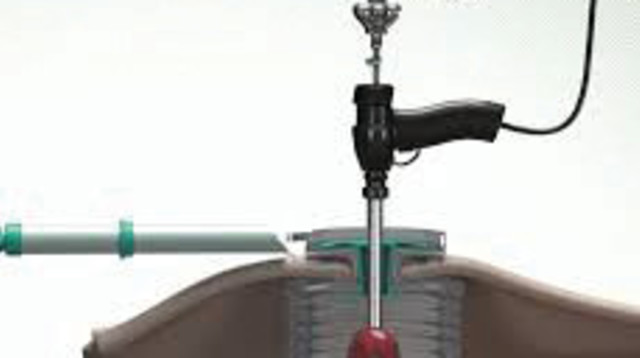 פתרון הLAP BOX (צילום: Ark surgical)