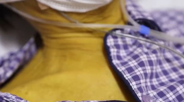 החולה הצהוב (צילום: רשתות חברתיות)