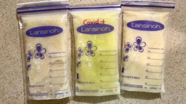 חלב אם רגיל VS חלב אם של חולת קורונה (צילום: רשתות חברתיות)