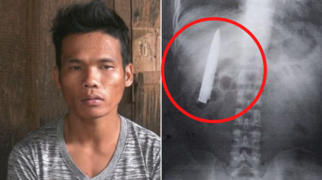 סכין בחזה (צילום: צילום מסך פייסבוק)