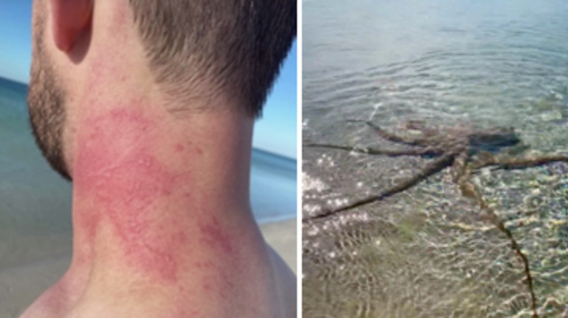 תמנון תקף גבר בחוף הים (צילום: צילום מסך מתוך רויטרס)