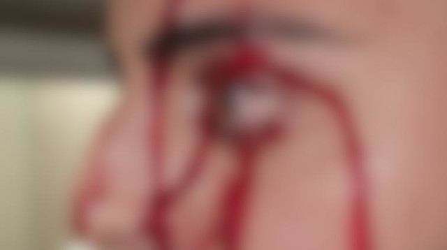 שוטר מדמם לאחר שהותקף במאה שערים (צילום: דוברות המשטרה)