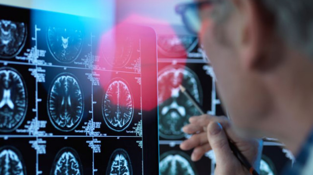 חקר המוח, אילוסטרציה (צילום: Getty images)