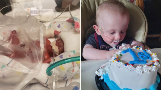 ריצ'רד נולד אחרי חמישה חודשי הריון ושרד (צילום: Guinness World Records)