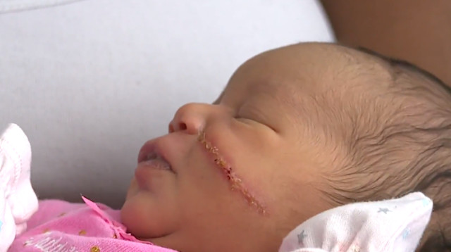 התינוקת שנחתכה בזמן לידתה (צילום: GoFundMe)