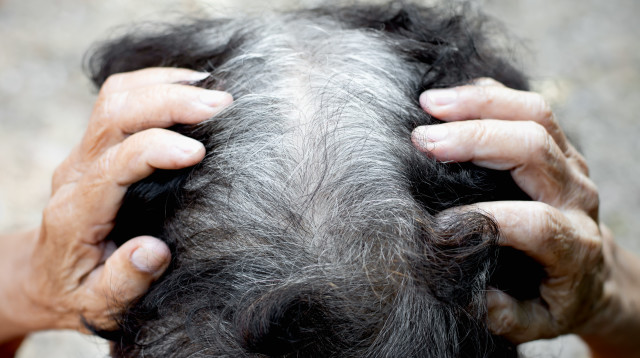 שיער שיבה (צילום: ingimage ASAP)