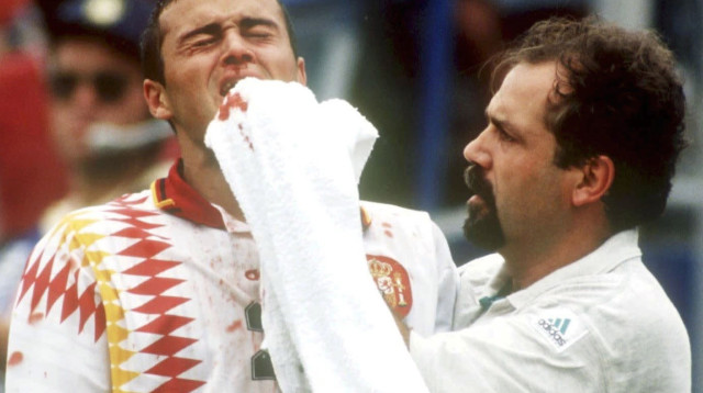 לואיס אנריקה מדמם מול איטליה במונדיאל 1994 (צילום: Henri Szwarc/Bongarts/Getty Images)