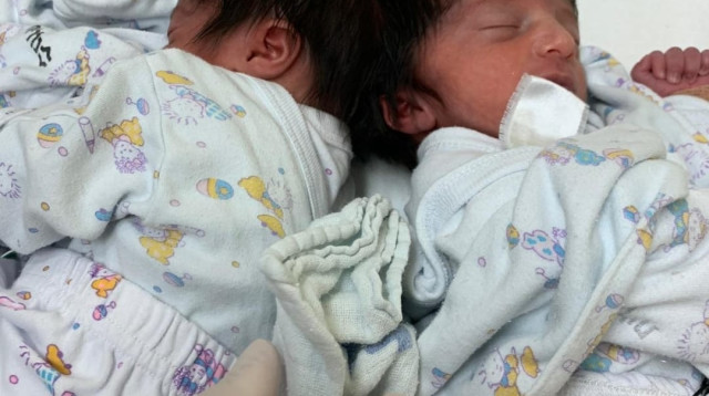 התאומות המחוברות בראשן (צילום: דוברות בית החולים סורוקה)