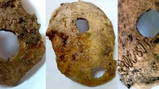 ניתוח מוח בן 5,000 שנה (צילום:  Roman Smolyaninov - Getty Images)