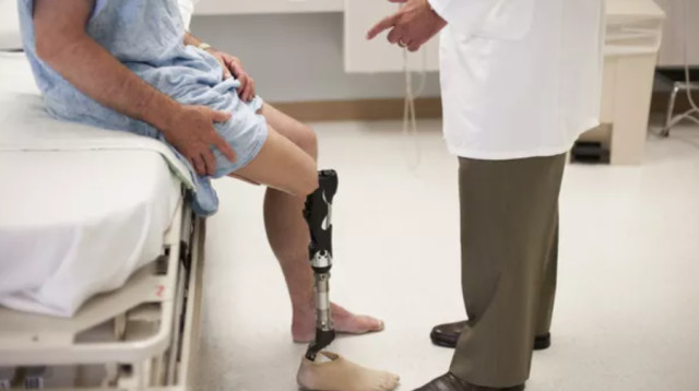 כריתת רגל, אילוסטרציה (צילום: ingimage ASAP)