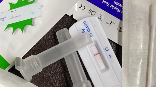 בדיקת אנטיגן (צילום: אבשלום ששוני)