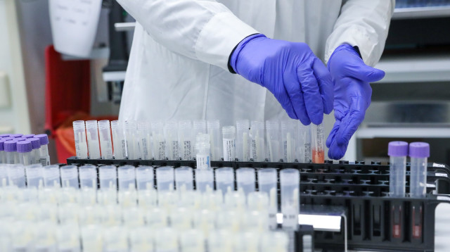 מעבדת קורונה  (צילום: מרק ישראל סלם)